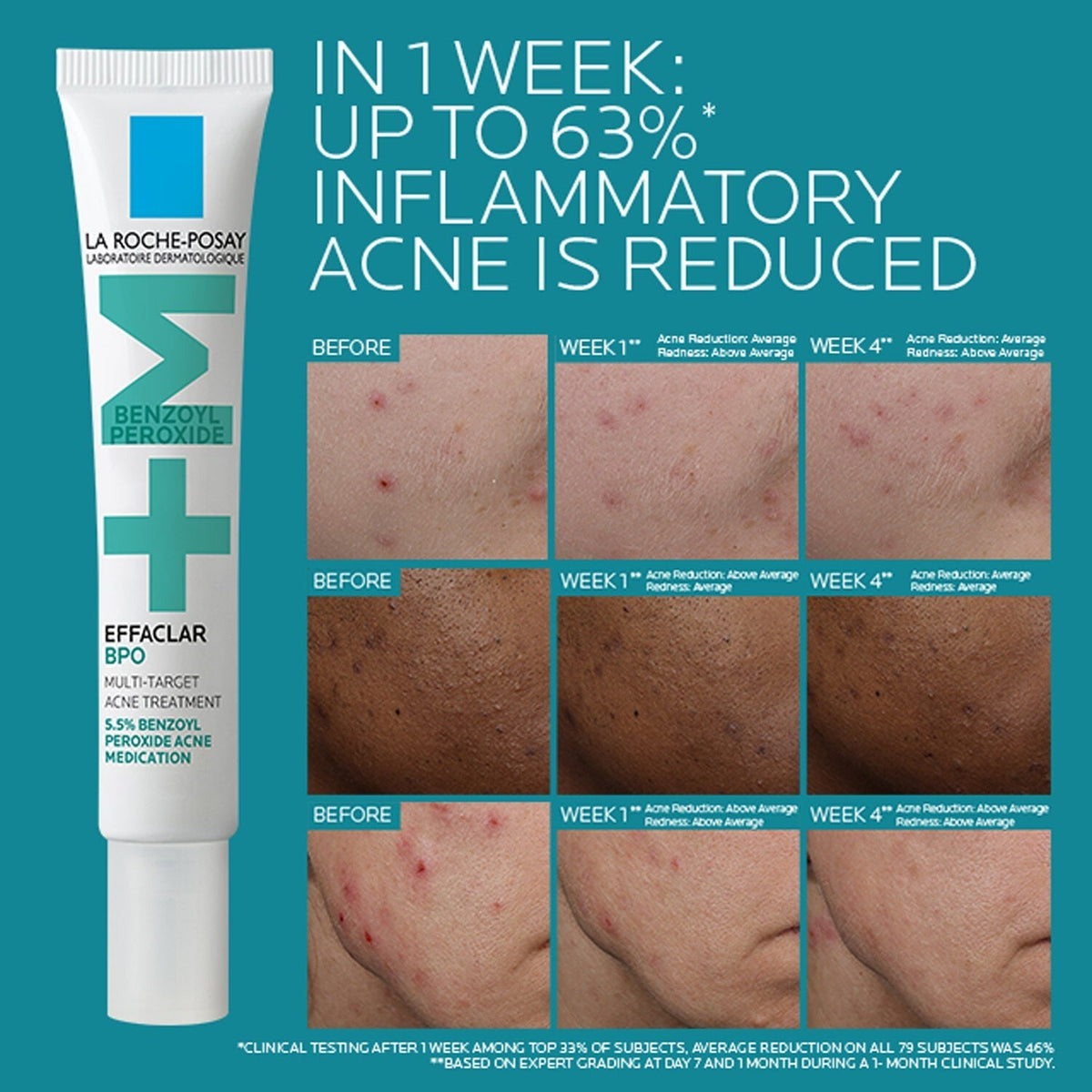 Effaclar BPO Multi-Target Acne Treatment with 5.5% Benzoyl Peroxide
